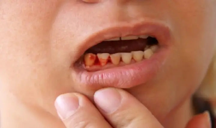 Giải Mã Giấc Mơ Đi Nhổ Mạ: Ý Nghĩa, Điềm Báo Và Con Số Đánh Đề Chuẩn Nhất