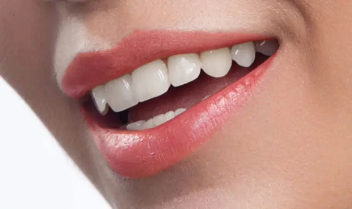 Giải Nghĩa Răng Hàm Dưới Không Đều Trong Nhân Tướng Học: Tính Cách Và Vận Mệnh Người Sở Hữu